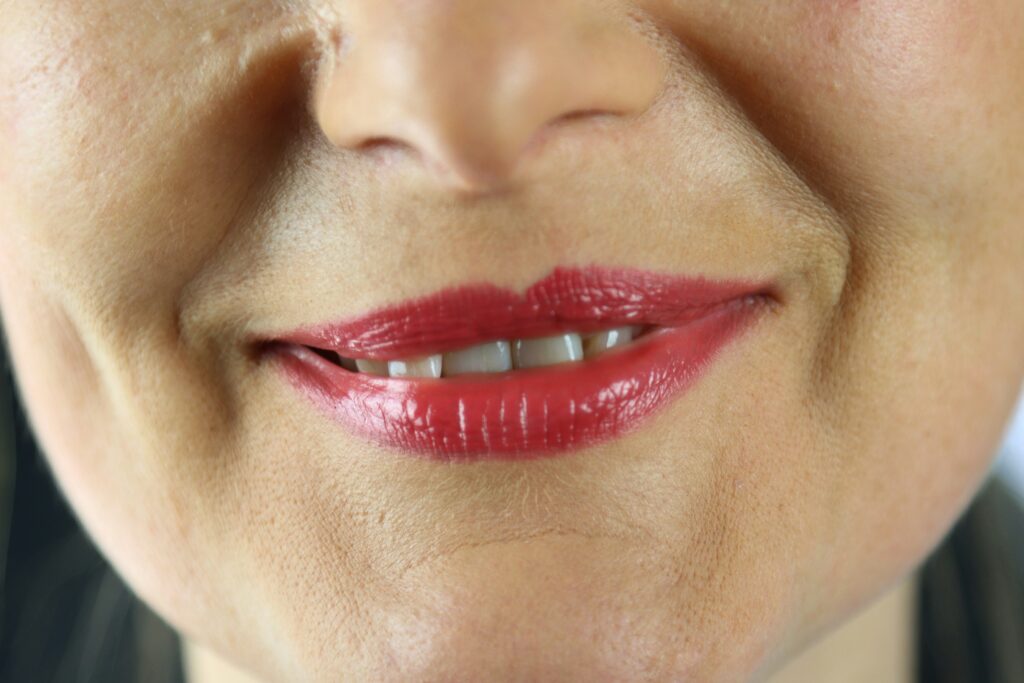 Lip Flip Before and After guide to procedure, treatment benefits, recovery, expected outcomes, aftercare, and lasting results.