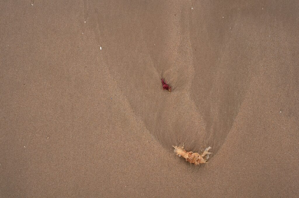 Sand Flea Bites covering bite symptoms, itch relief, treatment, prevention, healing, and outdoor safety.