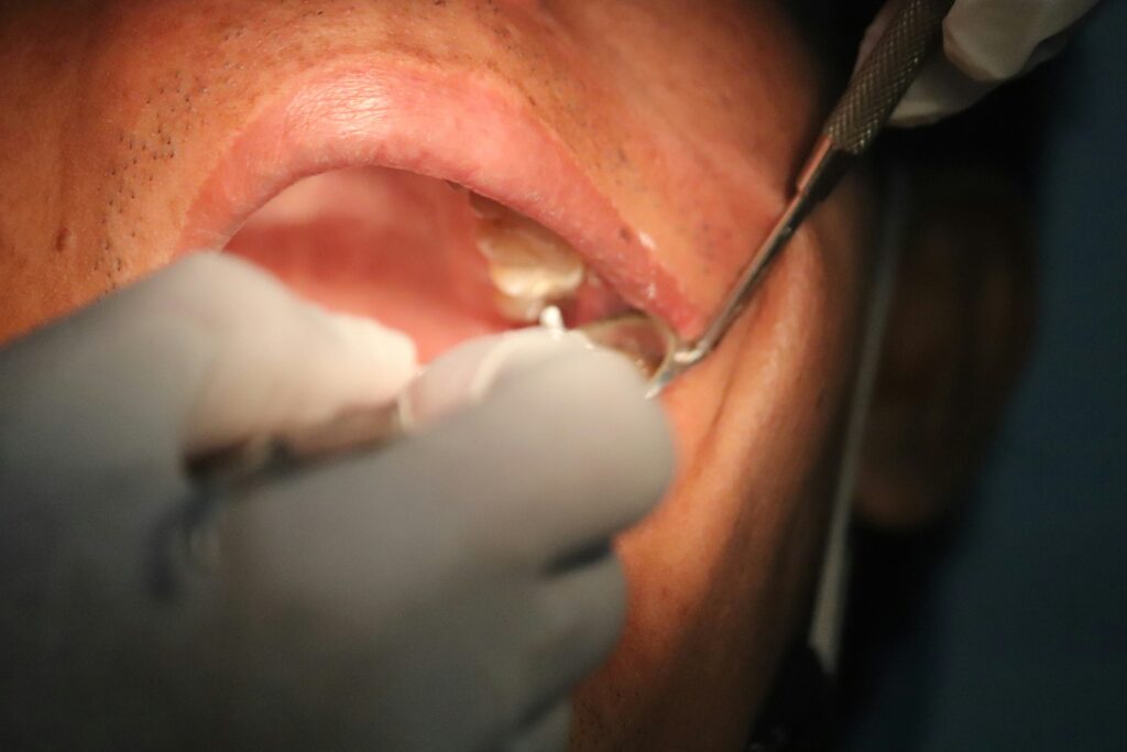 How Long to Wait to Eat After Composite Filling? guide to post-treatment eating, temperature sensitivity, hard foods, sticky foods, chewing, and dental aftercare.